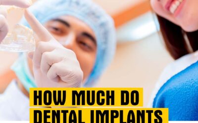 How Much Do Dental Implants Cost?