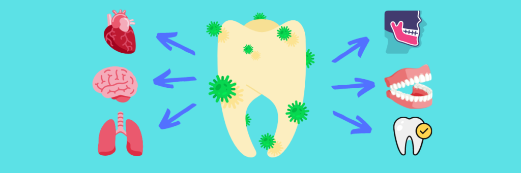 Can a Tooth Infection Spread?
