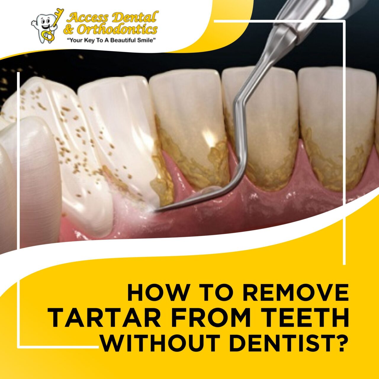 how to get rid of tartar on your teeth