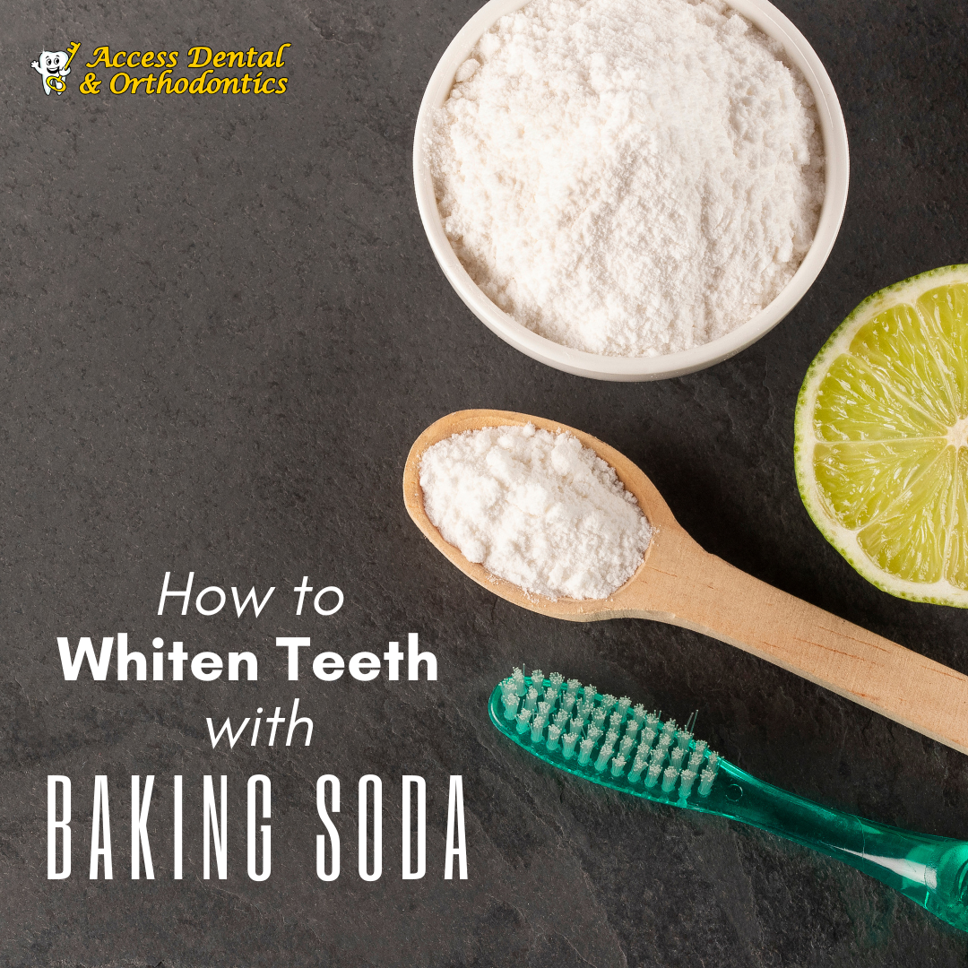 hydrogen peroxide baking soda teeth whitening before after