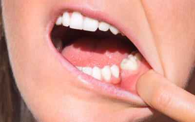 Why Do My Surrounding Teeth Hurt After An Extraction?