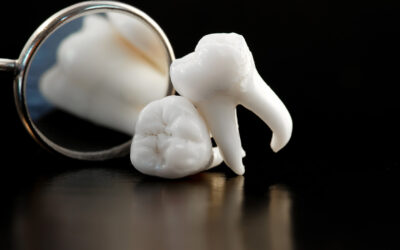 A Comprehensive Guide to Tooth Replacement Options After Extraction