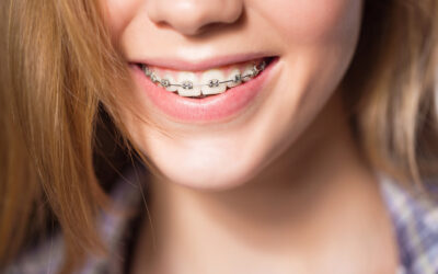 Wisdom Teeth Removal Before Braces: What You Need to Know