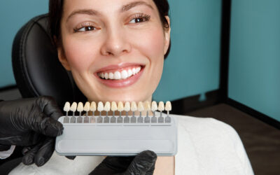 All You Need to Know About Veneers